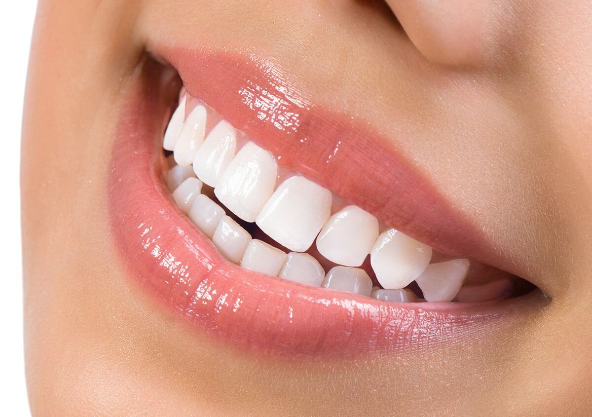 Zoom Teeth Whitening Dentist in American Fork Utah Area